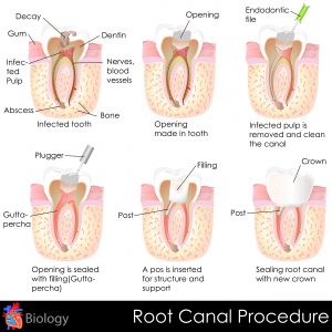 The dentist in Leesburg explains the causes and treatments of tooth pain. 