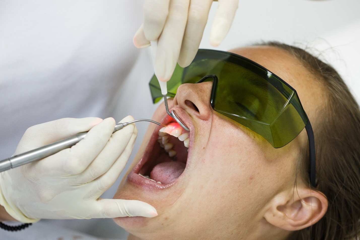 Laser Dentistry Can Treat Receding Gums in Leesburg