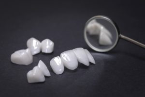 All-ceramic restorations for full mouth reconstruction in Leesburg. 