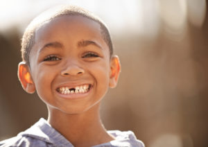 boy with tooth missing